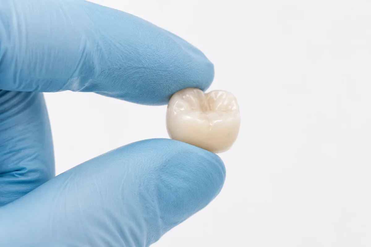 Porcelain dental crown held in gloved fingers