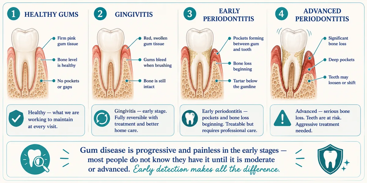Close-up of inflamed gums illustrating untreated gum disease at Rabbit Creek Dental in Mobile, AL