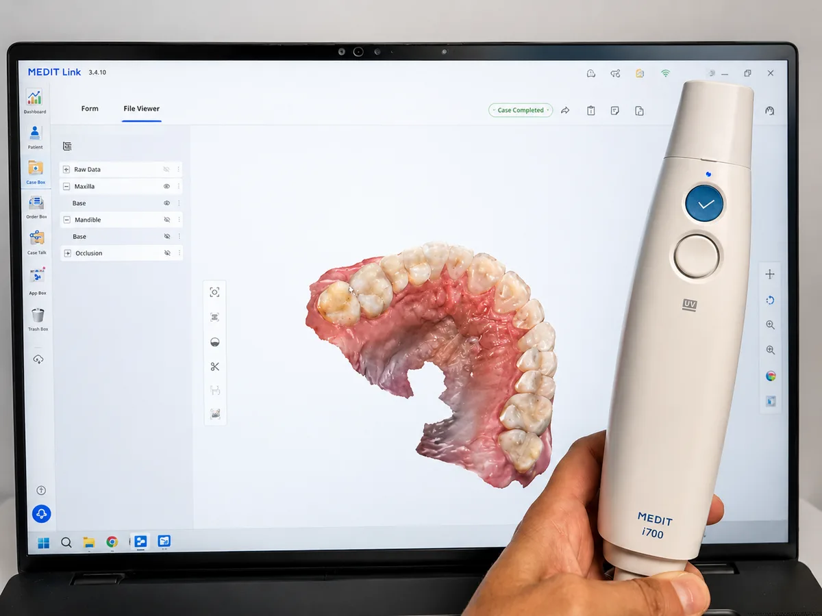 Medit i700 intraoral scanner with 3D scan displayed on screen at Rabbit Creek Dental